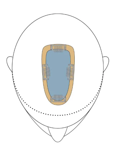 easiPart French 12 - Image 6