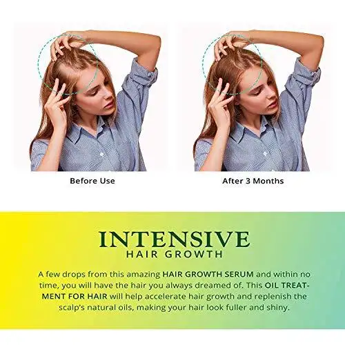 Hair Growth Serum - Image 5