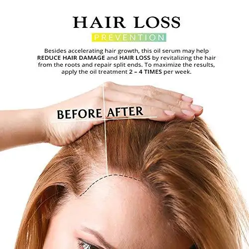 Hair Growth Serum - Image 6