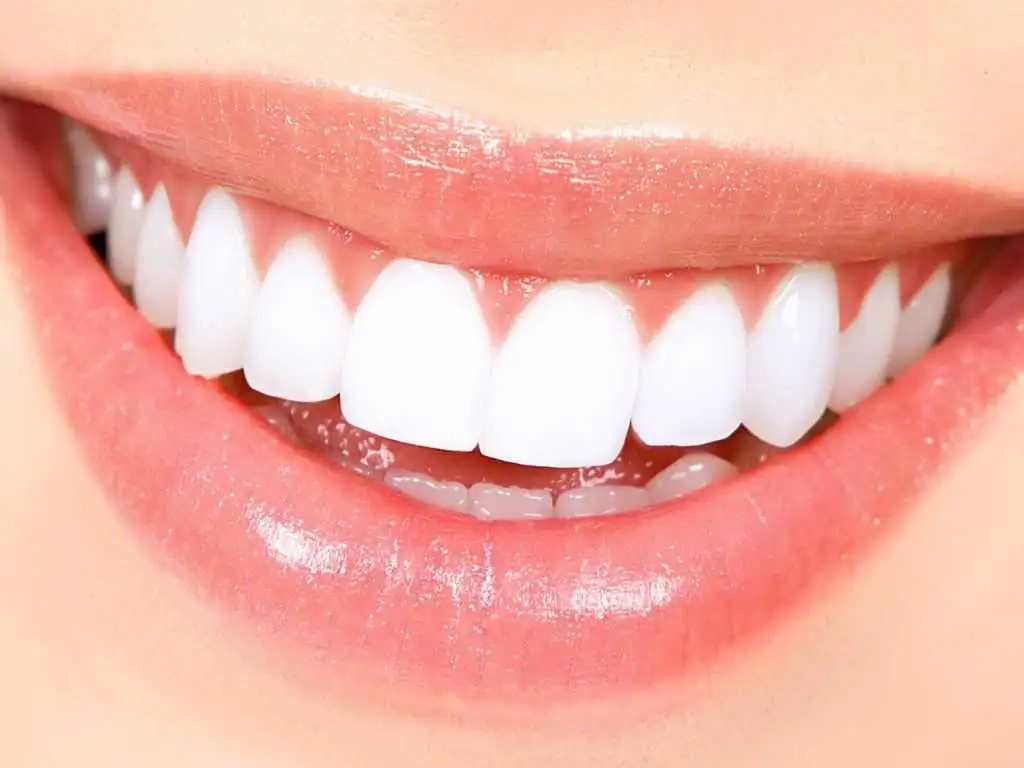 White Light Teeth Whitening System - Image 3